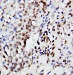 ERK1 Antibody in Immunohistochemistry (Paraffin) (IHC (P))