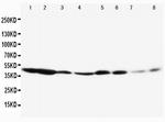 ERK1 Antibody in Western Blot (WB)