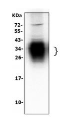 SFTPA1 Antibody in Western Blot (WB)