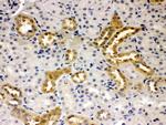 PSEN2 Antibody in Immunohistochemistry (Paraffin) (IHC (P))