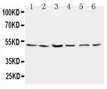 PSEN2 Antibody in Western Blot (WB)