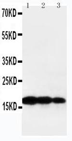 Human TNF beta Antibody in Western Blot (WB)