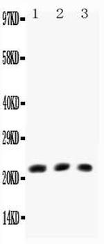 Human TNF beta Antibody in Western Blot (WB)