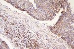 MEK3 Antibody in Immunohistochemistry (Paraffin) (IHC (P))