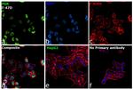 Progesterone Receptor Antibody