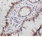 Progesterone Receptor Antibody in Immunohistochemistry (Paraffin) (IHC (P))