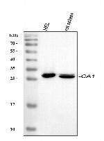 Carbonic Anhydrase I Antibody in Western Blot (WB)