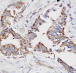 Osteopontin Antibody in Immunohistochemistry (Paraffin) (IHC (P))