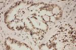 FGFR1 Antibody in Immunohistochemistry (Paraffin) (IHC (P))