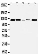 FGFR1 Antibody in Western Blot (WB)