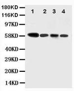 Caspase 10 Antibody in Western Blot (WB)