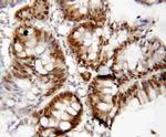 FOXP1 Antibody in Immunohistochemistry (Paraffin) (IHC (P))