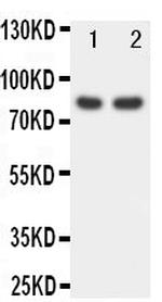 FOXP1 Antibody in Western Blot (WB)