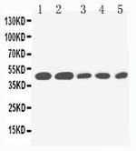 IL2RG Antibody in Western Blot (WB)