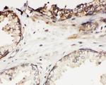 Kallikrein 11 Antibody in Immunohistochemistry (Paraffin) (IHC (P))