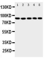 ALOX5 Antibody in Western Blot (WB)