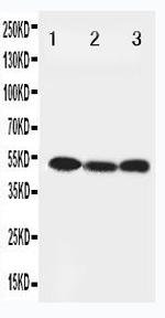 Beclin 1 Antibody in Western Blot (WB)