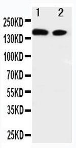 ErbB4 Antibody in Western Blot (WB)