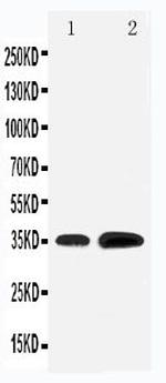 KLF3 Antibody in Western Blot (WB)