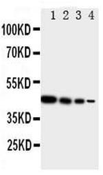 TRIF Antibody in Western Blot (WB)