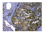 SQSTM1 Antibody in Immunohistochemistry (Paraffin) (IHC (P))