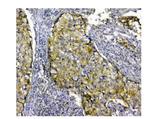 SQSTM1 Antibody in Immunohistochemistry (Paraffin) (IHC (P))