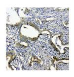 SQSTM1 Antibody in Immunohistochemistry (Paraffin) (IHC (P))