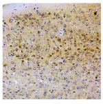 SQSTM1 Antibody in Immunohistochemistry (Paraffin) (IHC (P))