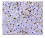 SQSTM1 Antibody in Immunohistochemistry (Paraffin) (IHC (P))