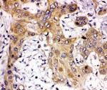 ZEB2 Antibody in Immunohistochemistry (Paraffin) (IHC (P))