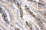 NRG1 Antibody in Immunohistochemistry (IHC)