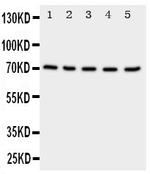 NRG1 Antibody in Western Blot (WB)