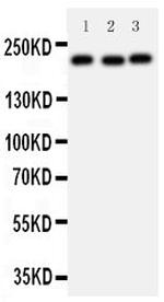 53BP1 Antibody in Western Blot (WB)