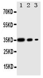 PERK Antibody in Western Blot (WB)