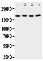 PLA2G4A Antibody in Western Blot (WB)