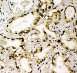 TBK1 Antibody in Immunohistochemistry (Paraffin) (IHC (P))