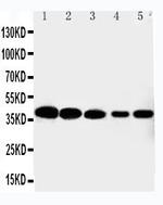 CDK7 Antibody in Western Blot (WB)