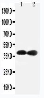 CDK7 Antibody in Western Blot (WB)