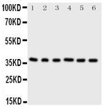 CDK7 Antibody in Western Blot (WB)