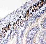 NKCC1 Antibody in Immunohistochemistry (Paraffin) (IHC (P))