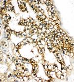 COMT Antibody in Immunohistochemistry (Paraffin) (IHC (P))