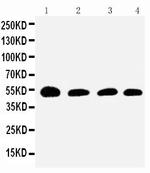 SERPINC1 Antibody in Western Blot (WB)