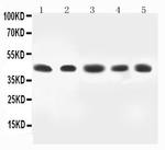 MAP2K4 Antibody in Western Blot (WB)