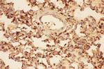 Cofilin Antibody in Immunohistochemistry (Paraffin) (IHC (P))