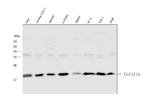 Cofilin Antibody in Western Blot (WB)