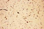 ACTH Antibody in Immunohistochemistry (Paraffin) (IHC (P))