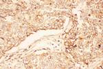 AKT2 Antibody in Immunohistochemistry (Paraffin) (IHC (P))