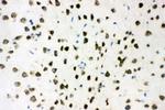 AKT2 Antibody in Immunohistochemistry (Frozen) (IHC (F))