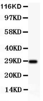 BDNF Antibody in Western Blot (WB)