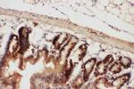 Beclin 1 Antibody in Immunohistochemistry (Paraffin) (IHC (P))